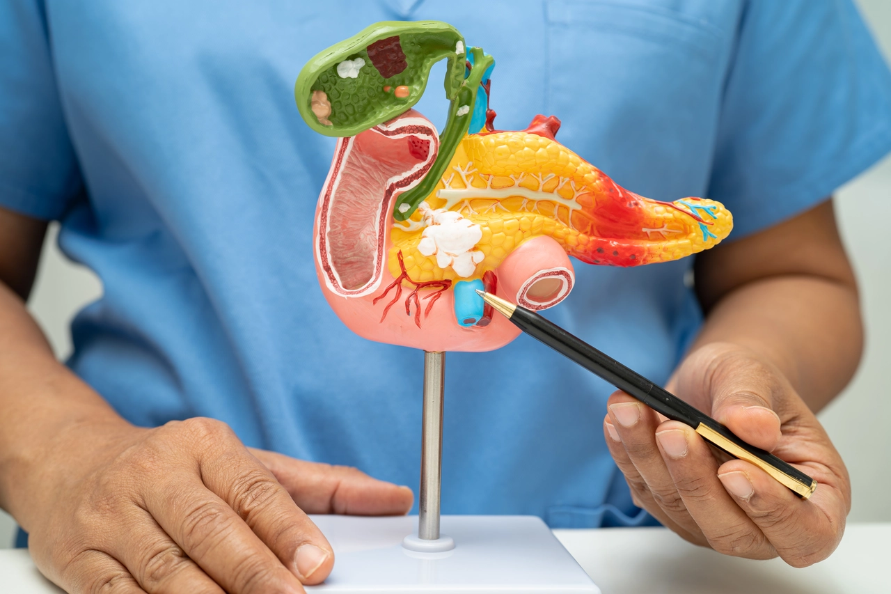Sei in cura contro il cancro? Ecco gli alimenti che aiutano davvero a sopportare le terapie