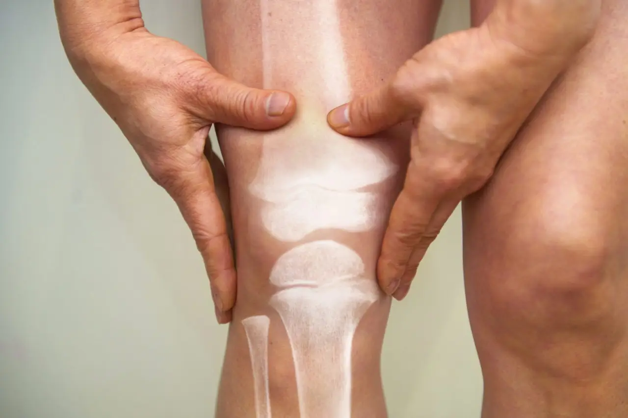 Soffri di osteoporosi? Ecco perché andare al mare è la cura naturale che rafforza le ossa