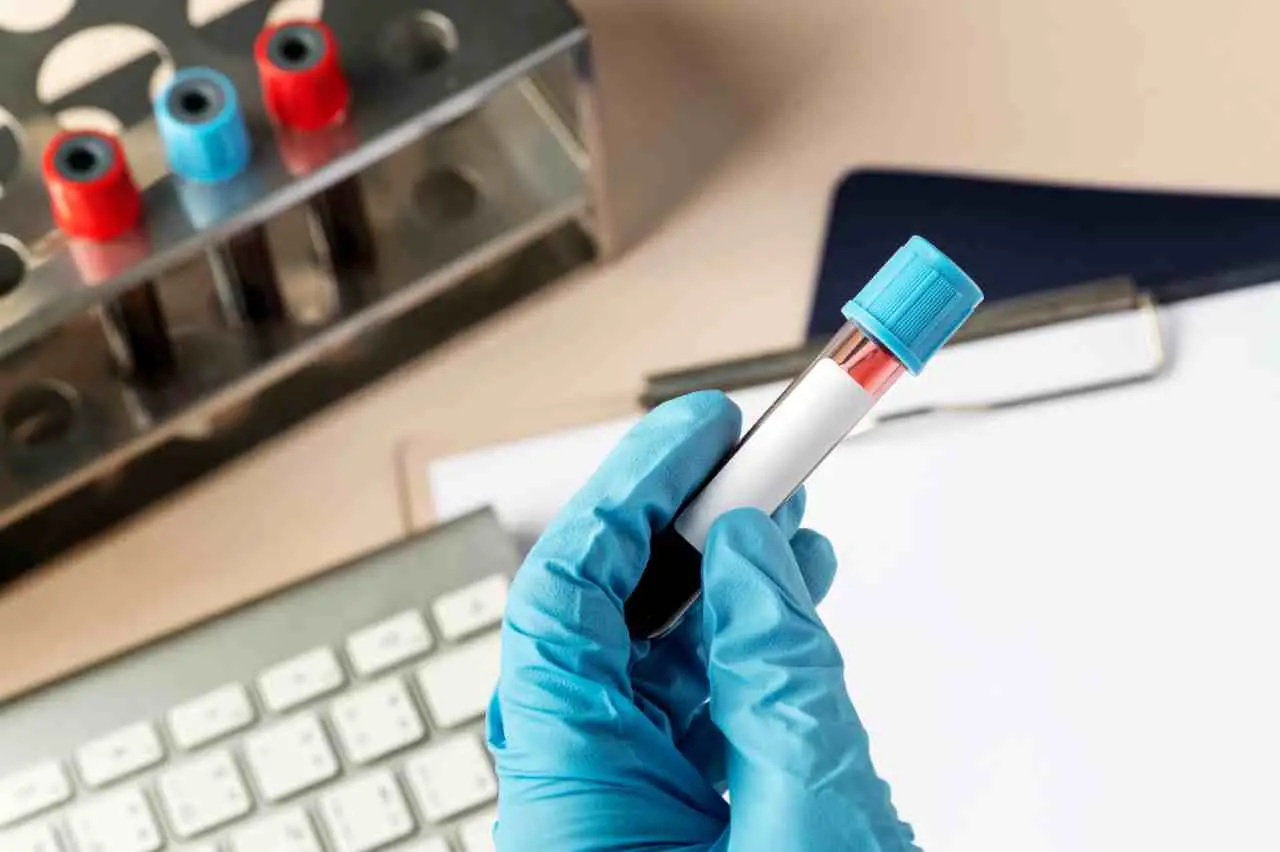 Vuoi sapere se hai le difese immunitarie basse? Ecco le analisi giuste da fare